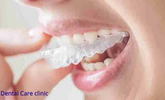 تقويم الاسنان